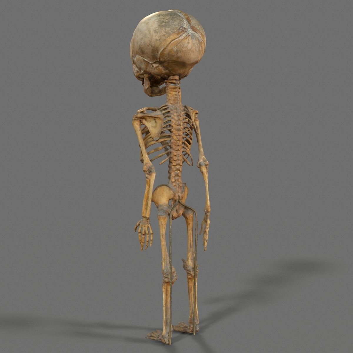 Foetus 3D printeable 3D print model_7