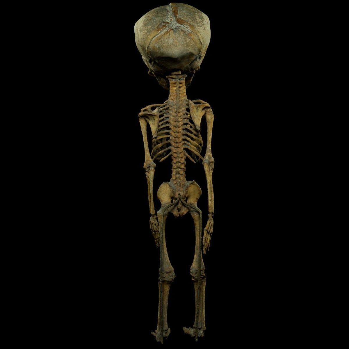 Foetus 3D printeable 3D print model_6