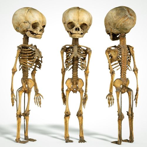 Foetus 3D printeable 3D print model
