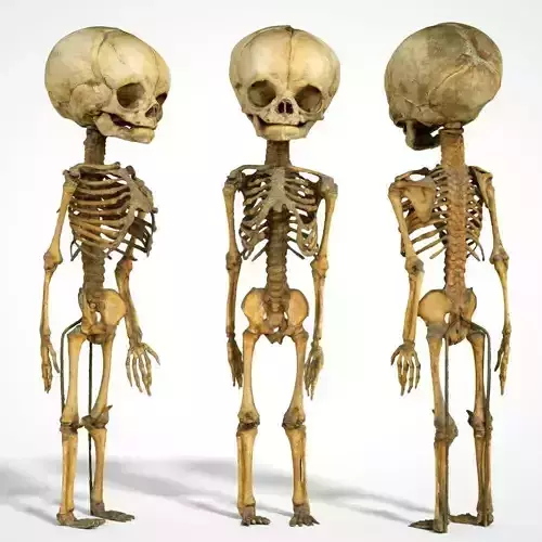 Foetus 3D printeable 3D print model