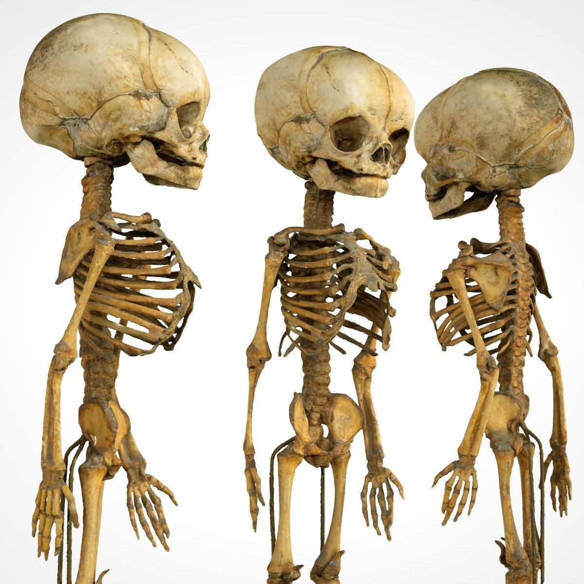 Foetus 3D printeable 3D print model_10