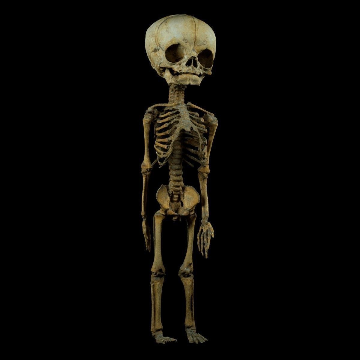 Foetus 3D printeable 3D print model_2