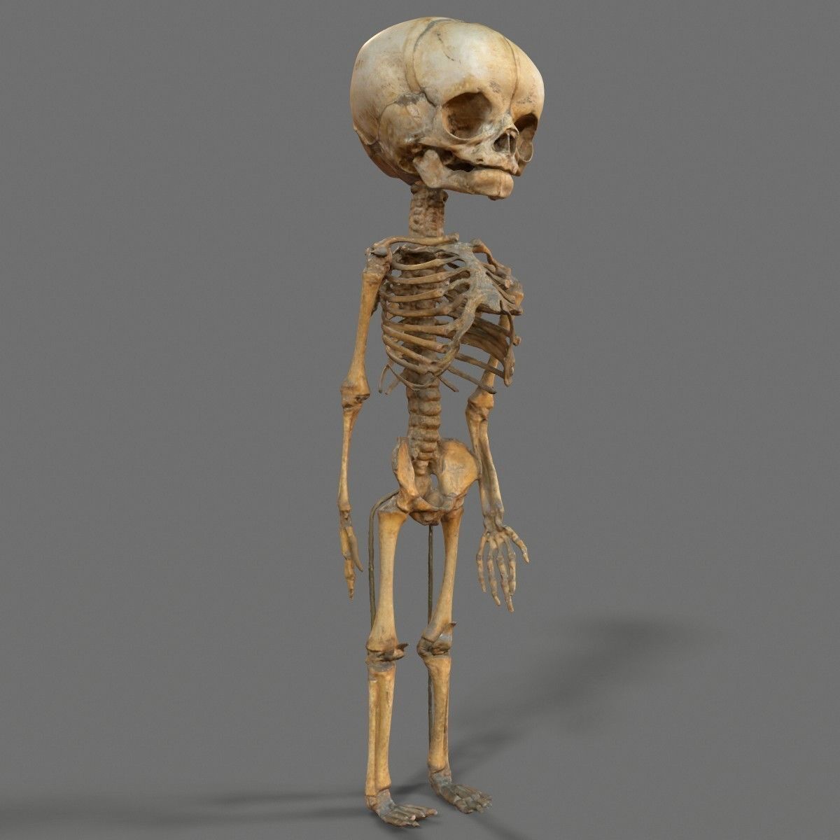 Foetus 3D printeable 3D print model_3