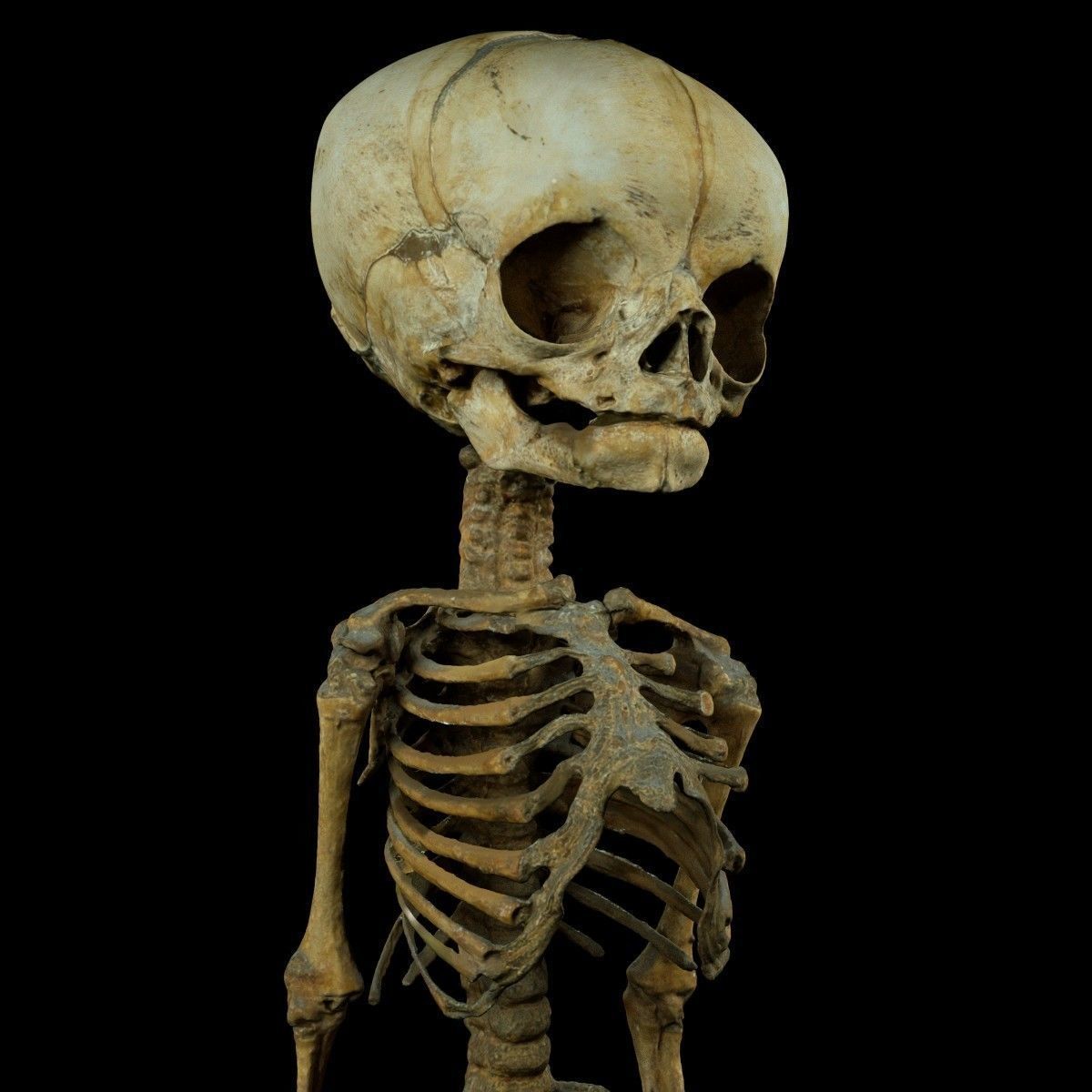 Foetus 3D printeable 3D print model_4