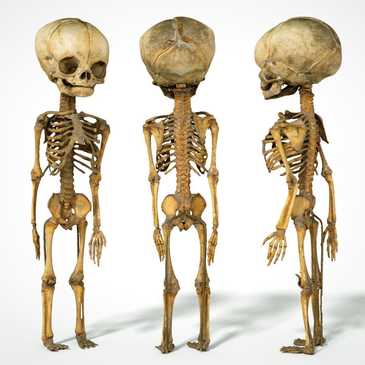 Foetus 3D printeable 3D print model_12