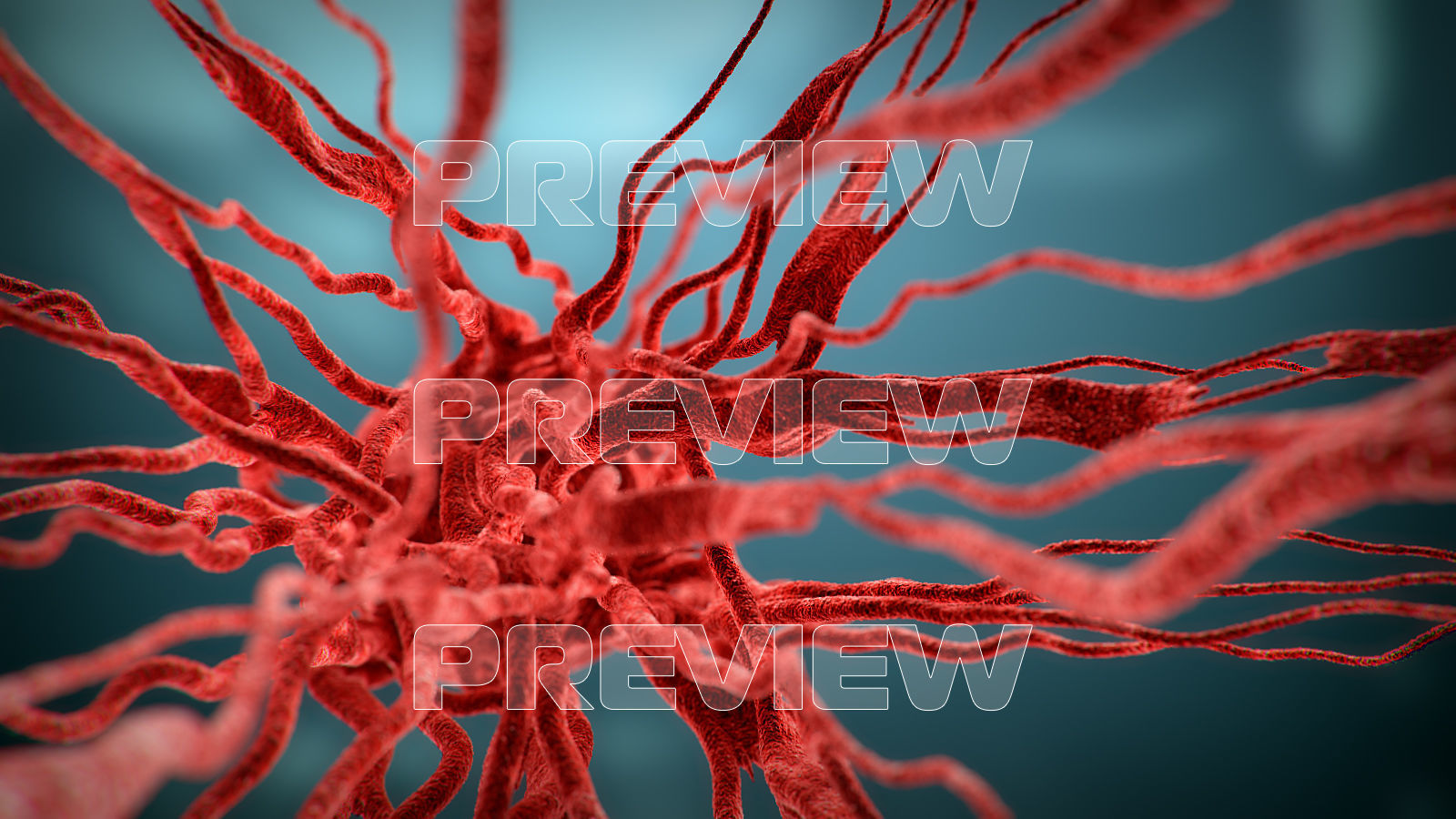 Cancer Growth 3 Static And Animated Obj Sequence 3D model_2