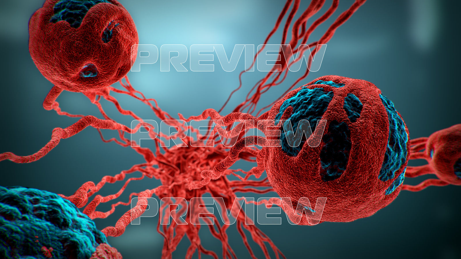 Cancer Growth 3 Static And Animated Obj Sequence 3D model_11