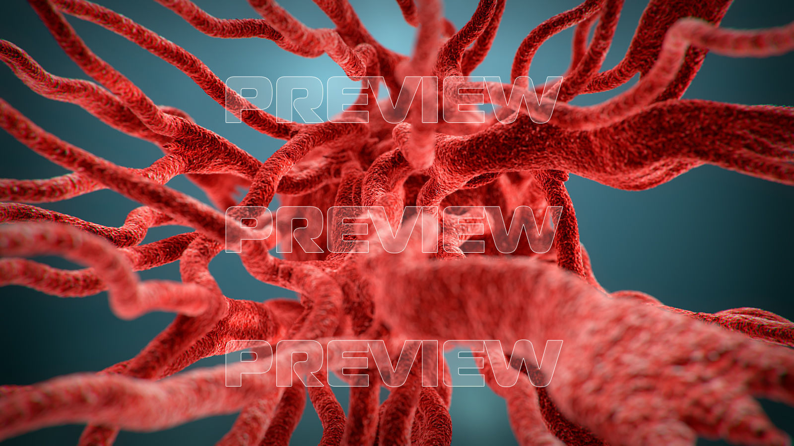 Cancer Growth 3 Static And Animated Obj Sequence 3D model_5