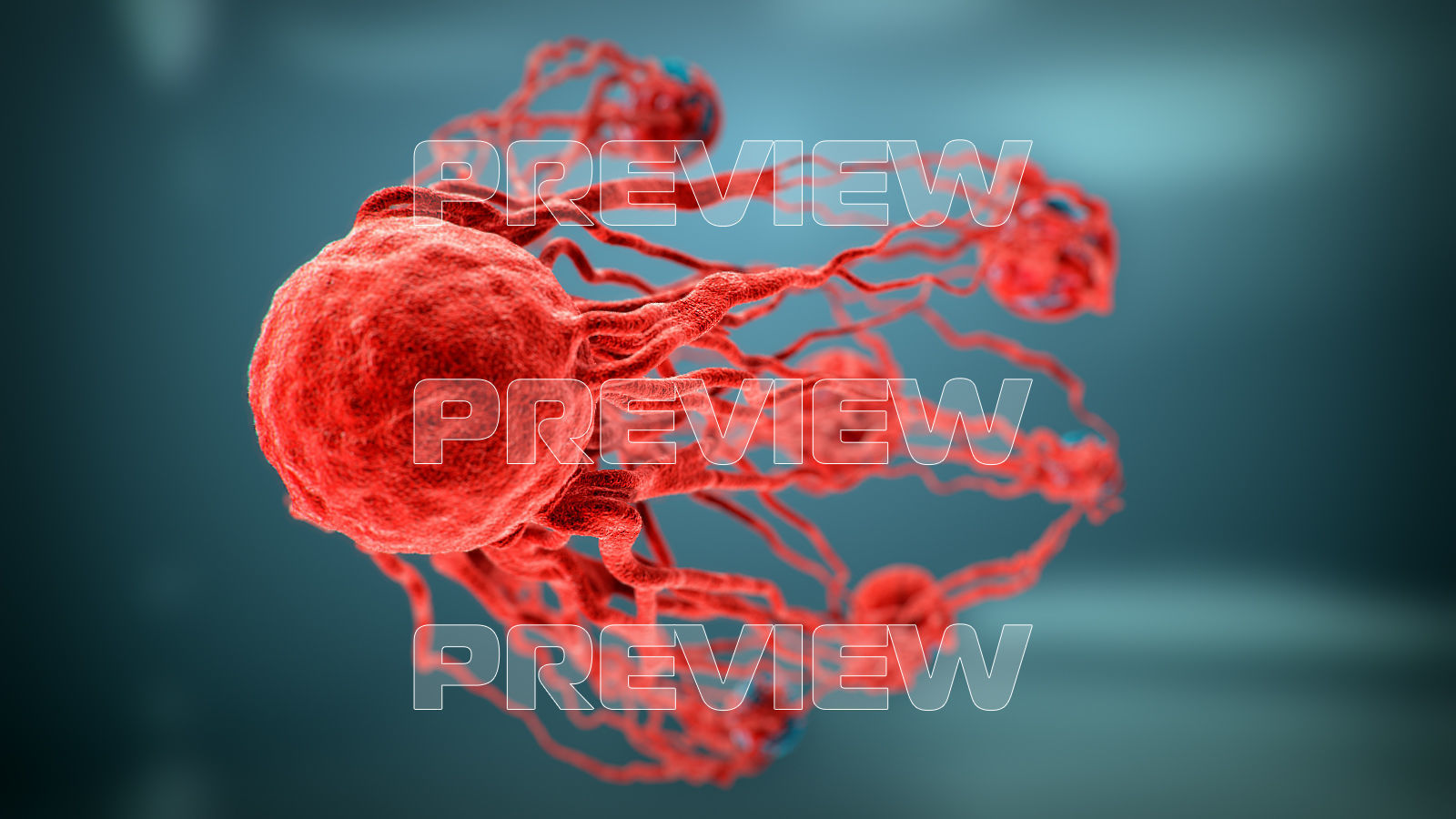 Cancer Growth 3 Static And Animated Obj Sequence 3D model_10