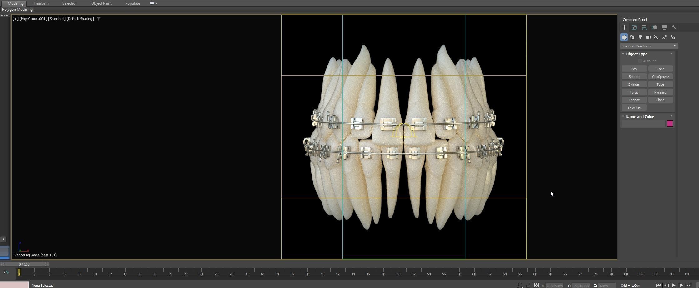 Teeth 3D model_22