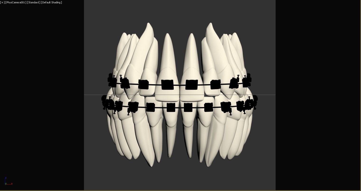 Teeth 3D model_15