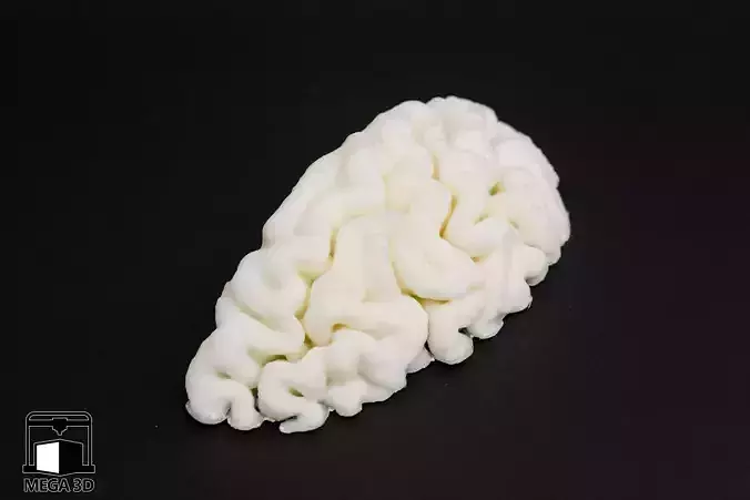 mri brain  3D print model