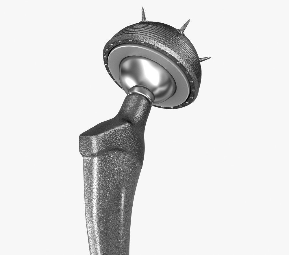 Hip replacement implant installed in the pelvis bone 3D model_11