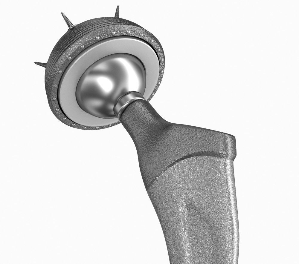 Hip replacement implant installed in the pelvis bone 3D model_12