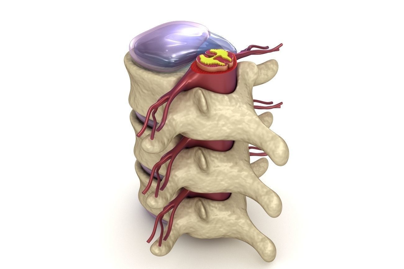 Hernaited  disc in human spine in details  3D model_11