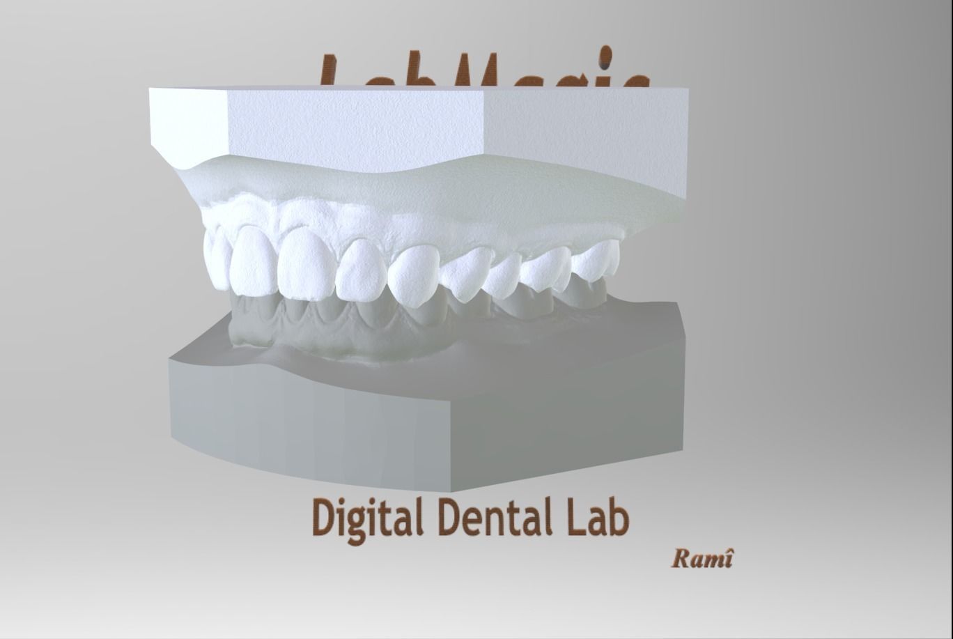 Digital Orthodontic Study Models with Virtual ABO Bases 3D print model_24