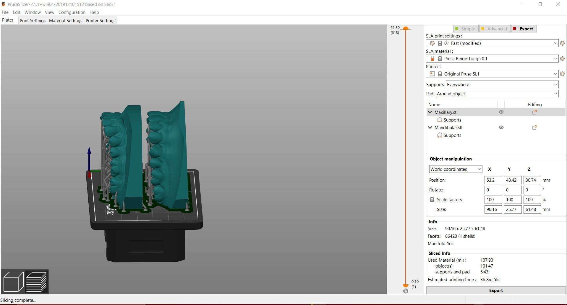 Digital Orthodontic Study Models with Virtual ABO Bases 3D print model_23