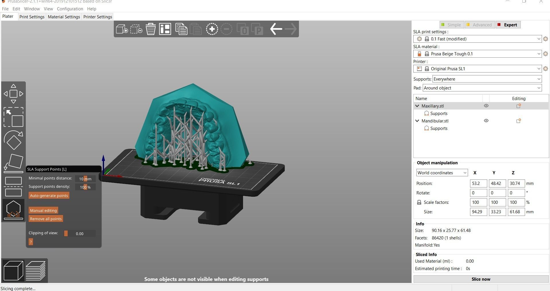Digital Orthodontic Study Models with Virtual ABO Bases 3D print model_22