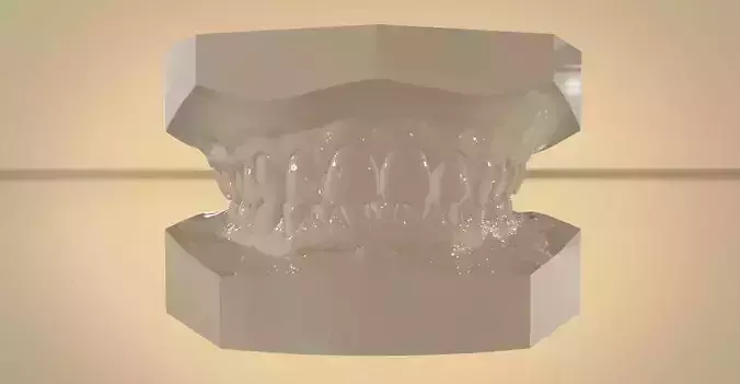 Digital Orthodontic Study Models with Virtual ABO Bases 3D print model