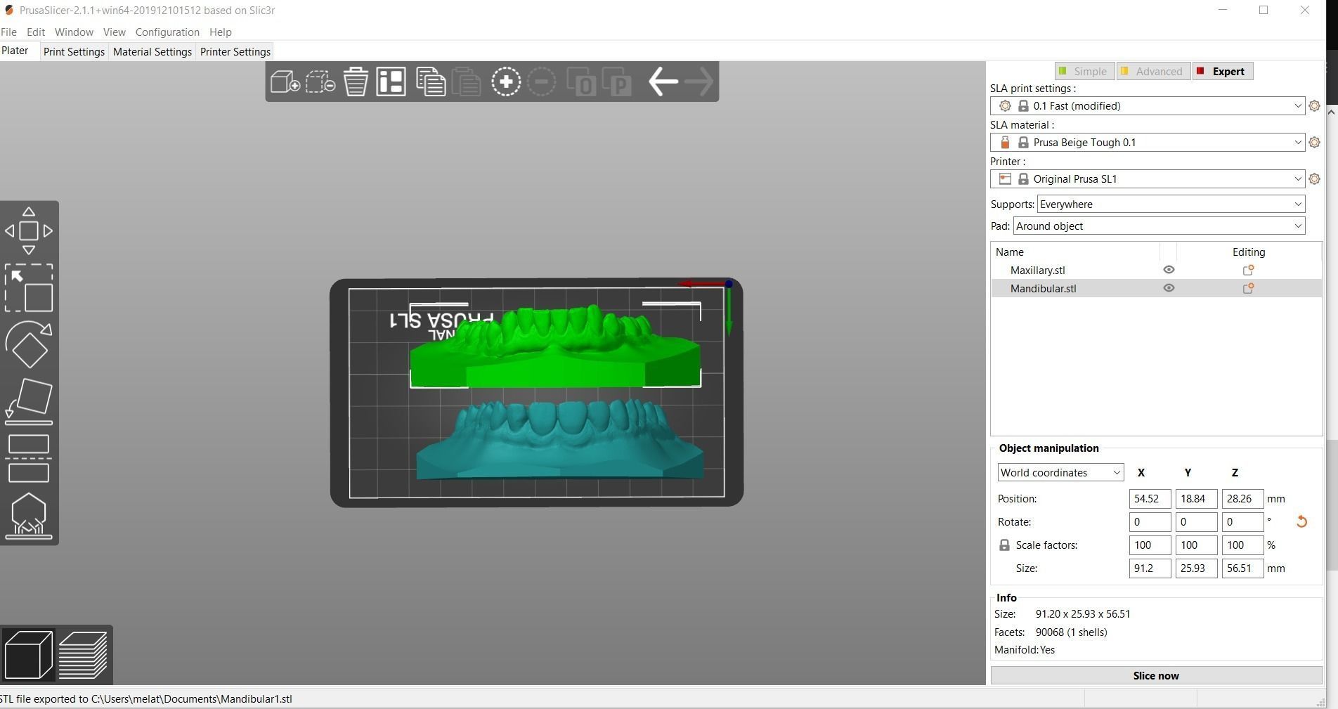 Digital Orthodontic Study Models with Virtual ABO Bases 3D print model_20