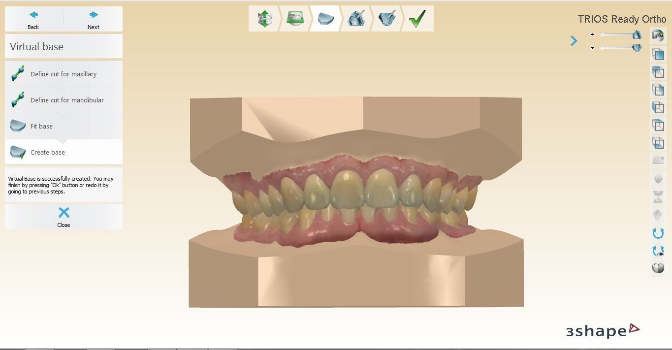 Digital Orthodontic Study Models with Virtual ABO Bases 3D print model_2