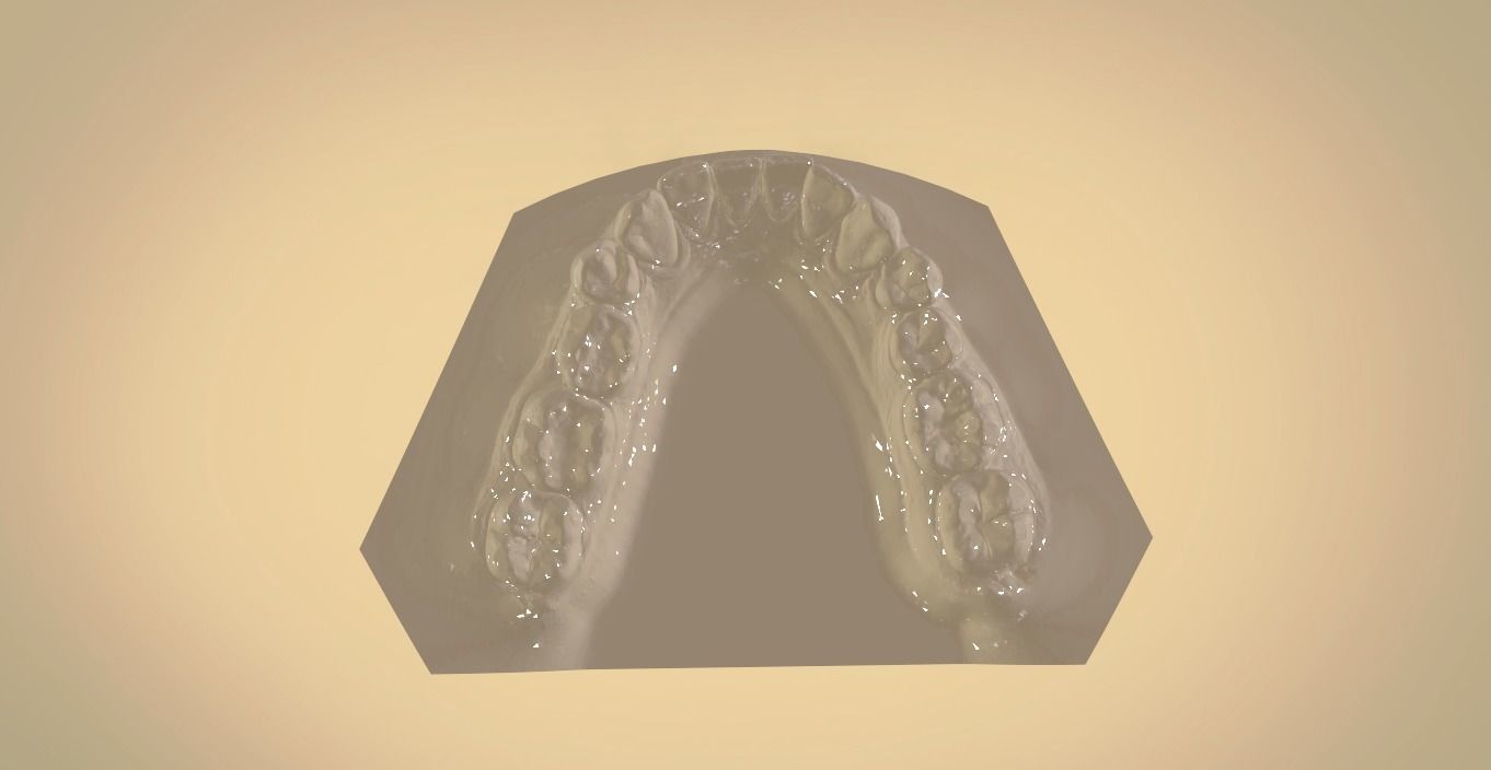 Digital Orthodontic Study Models with Virtual ABO Bases 3D print model_14