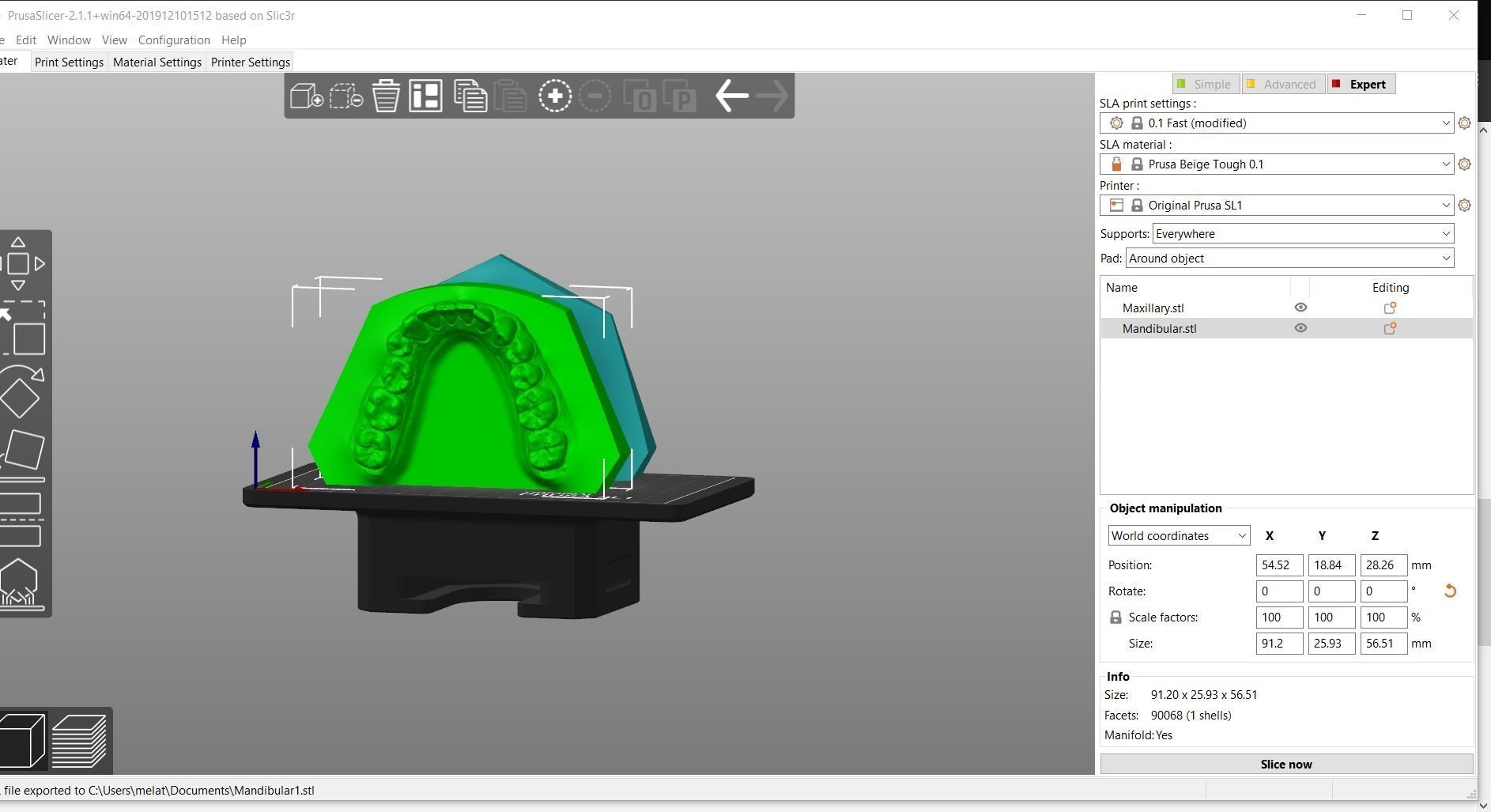 Digital Orthodontic Study Models with Virtual ABO Bases 3D print model_19