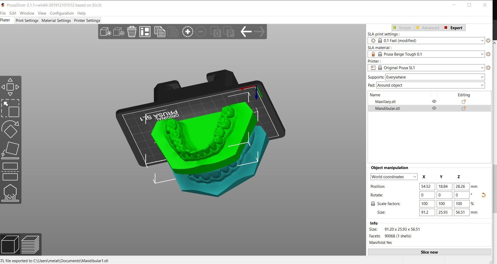 Digital Orthodontic Study Models with Virtual ABO Bases 3D print model_21