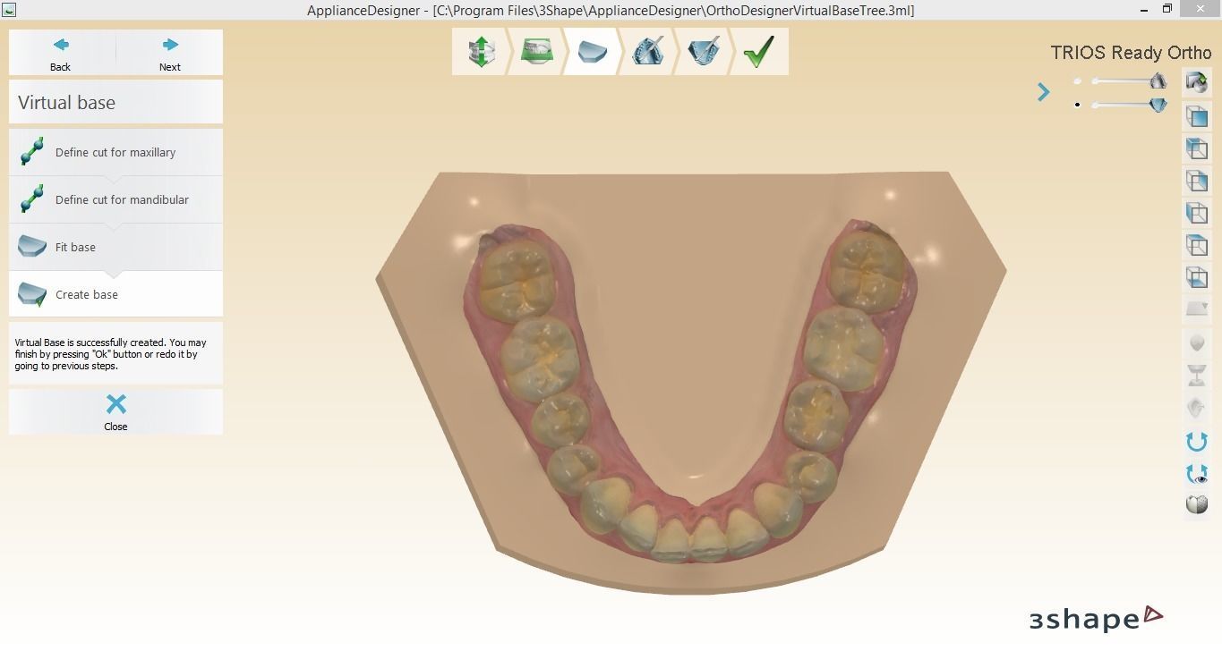 Digital Orthodontic Study Models with Virtual ABO Bases 3D print model_4