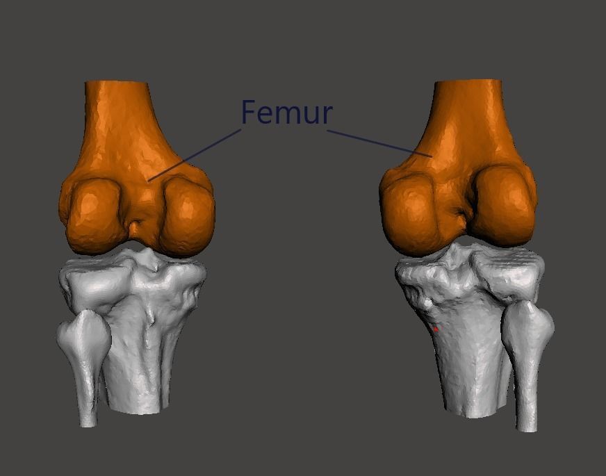 Knee joint - male - age 64 3D model_11
