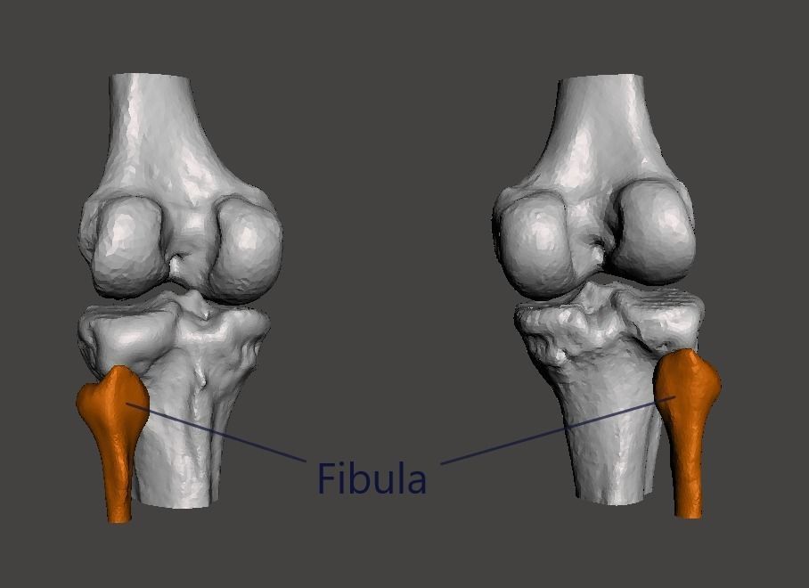 Knee joint - male - age 64 3D model_13