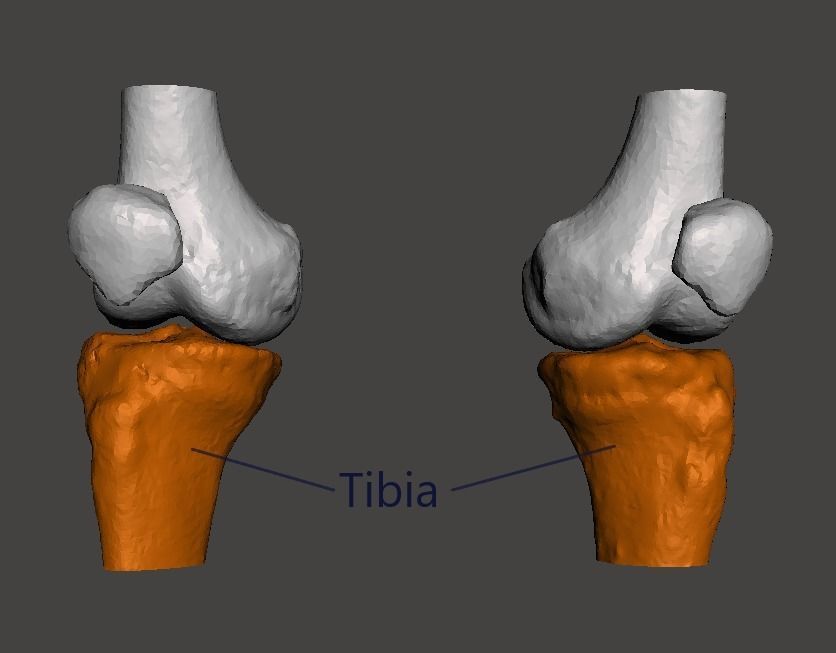 Knee joint - male - age 64 3D model_12