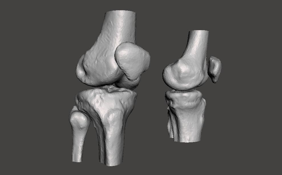 Knee joint - male - age 64 3D model_38