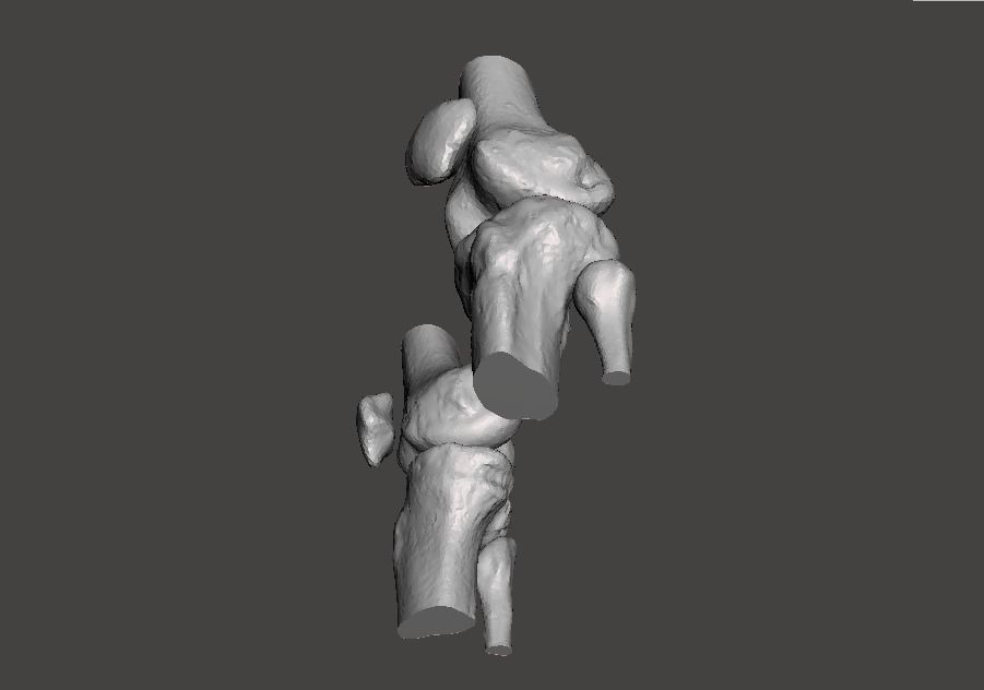 Knee joint - male - age 64 3D model_32