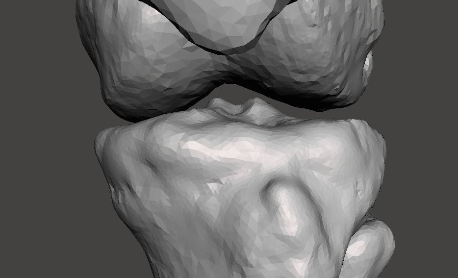 Knee joint - male - age 64 3D model_33