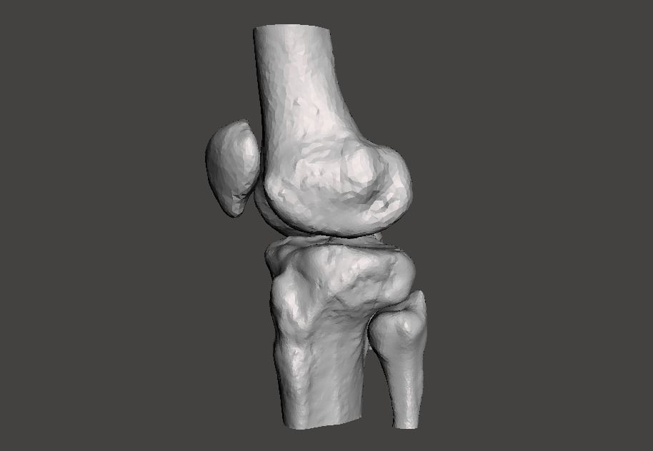 Knee joint - male - age 64 3D model_3