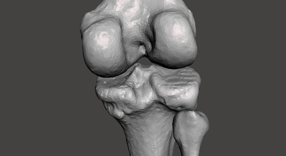 Knee joint - male - age 64 3D model_34