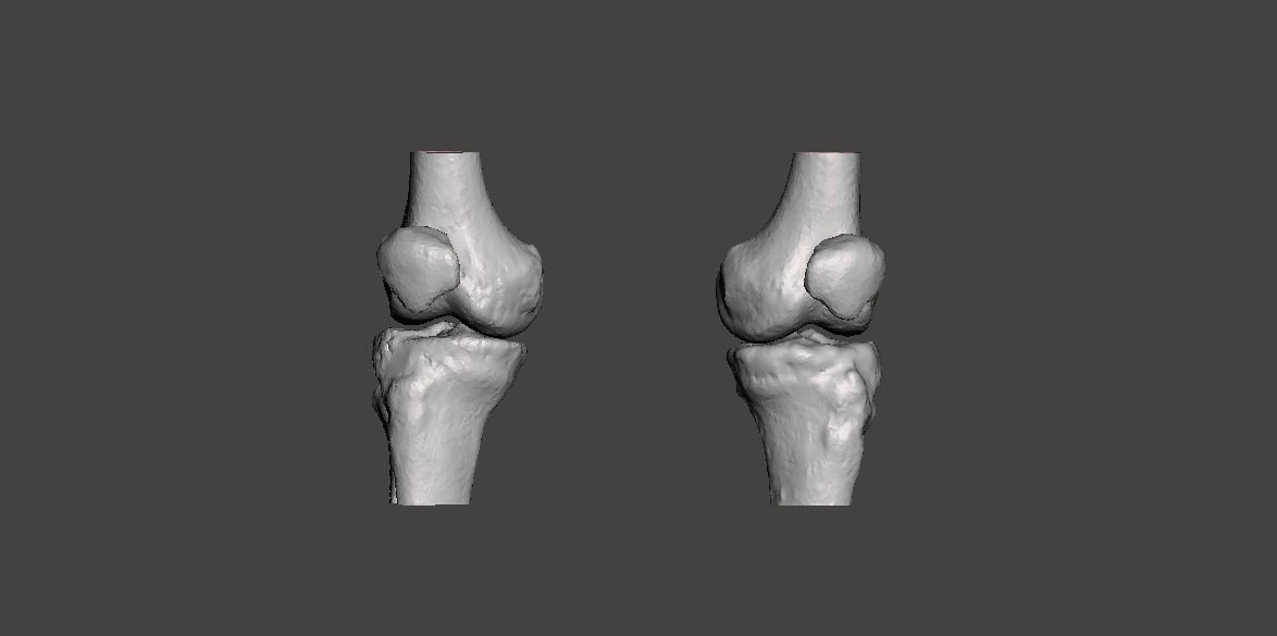 Knee joint - male - age 64 3D model_28