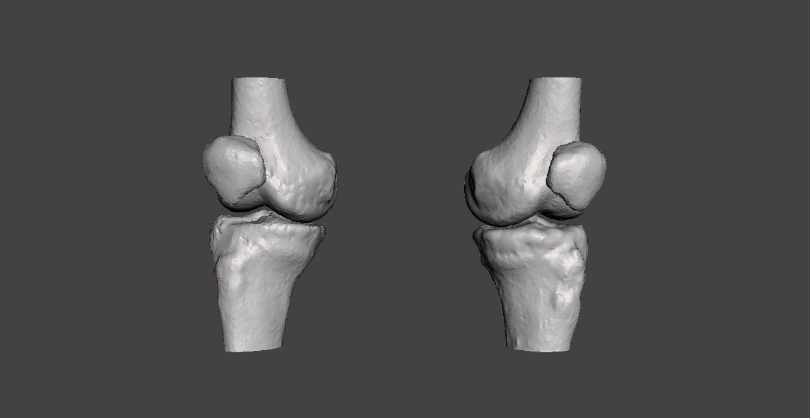 Knee joint - male - age 64 3D model_17