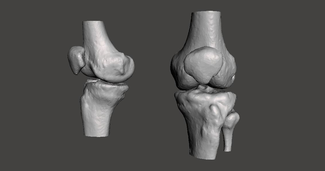 Knee joint - male - age 64 3D model_24