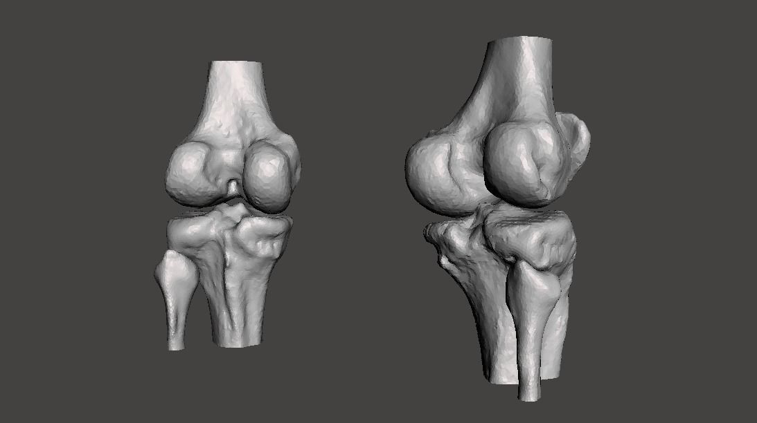 Knee joint - male - age 64 3D model_18