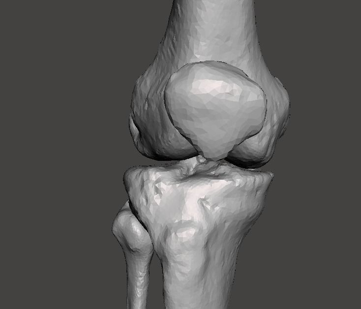 Knee joint - male - age 64 3D model_30