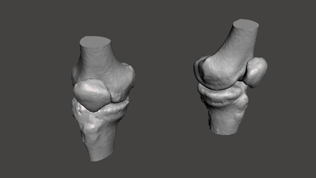 Knee joint - male - age 64 3D model_36
