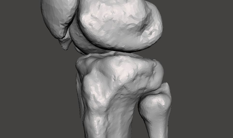 Knee joint - male - age 64 3D model_35