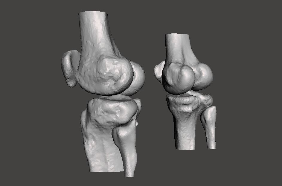Knee joint - male - age 64 3D model_4