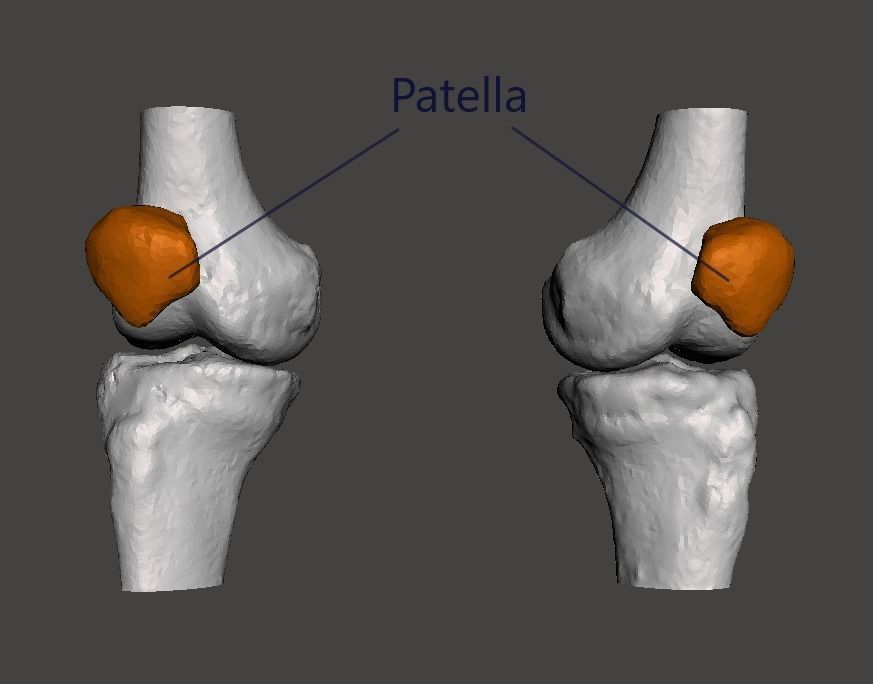 Knee joint - male - age 64 3D model_10