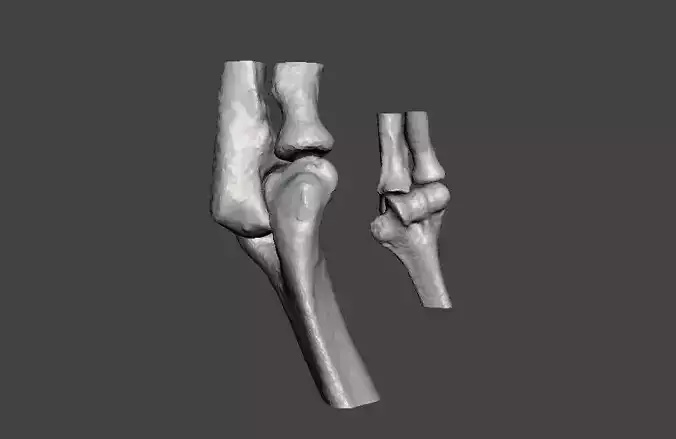 Elbows - female age 37 3D model