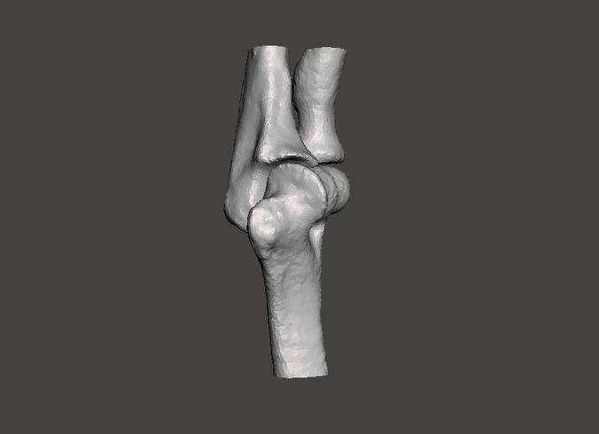 Left elbow - female - age 37 3D model