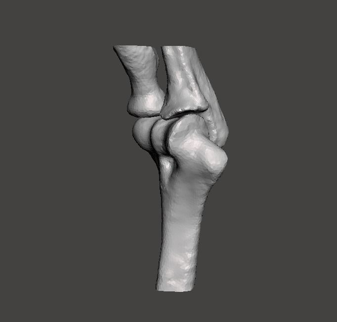 Right elbow - female - age 37 3D model_2