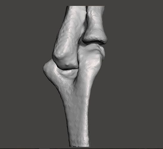 Right elbow - female - age 37 3D model